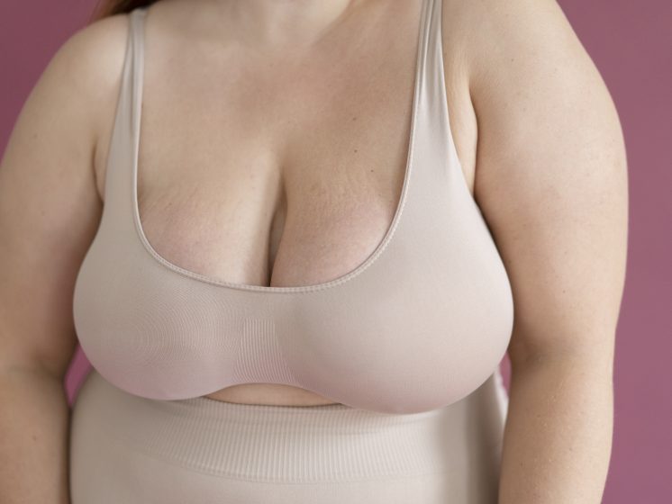 Breast-augmentation